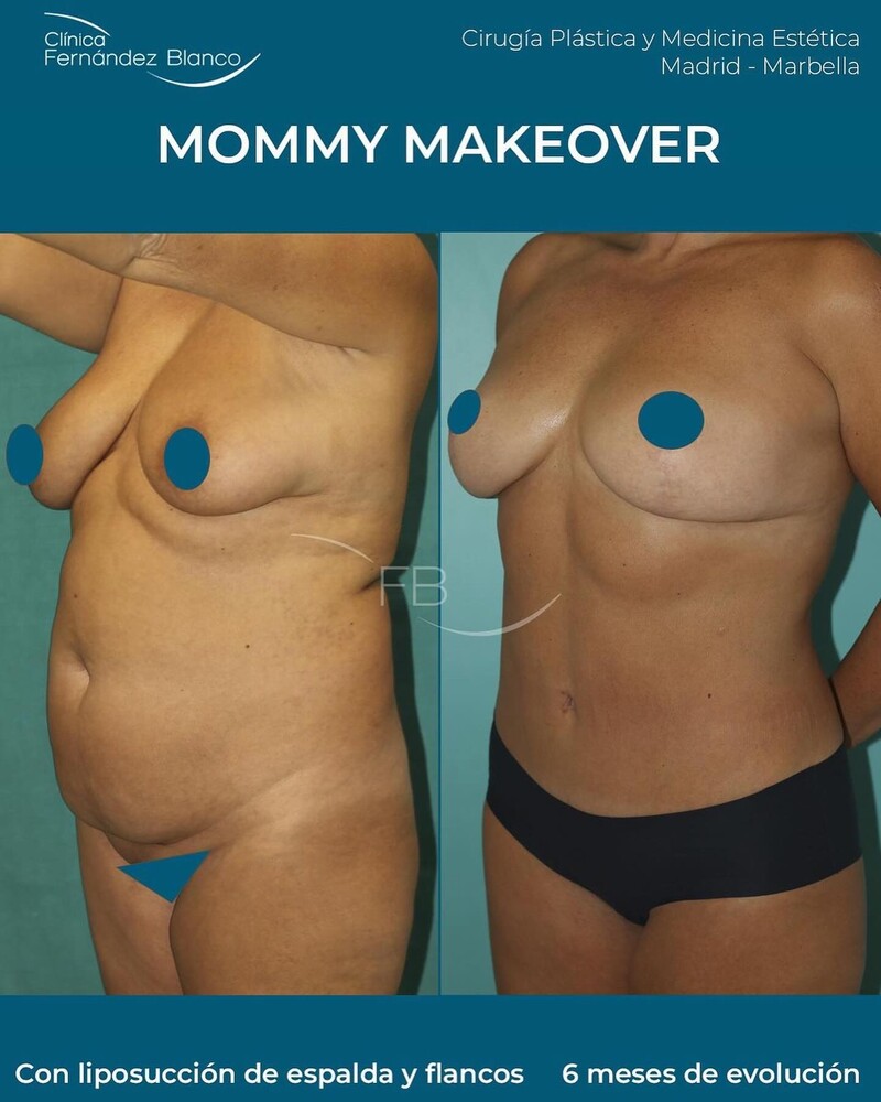 Clinic Results Gallery